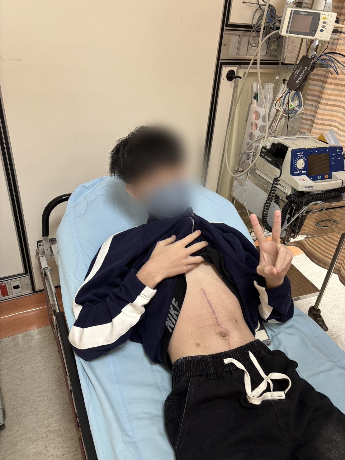 另一位年輕傷者腹部的正中線疤痕;鏡頭拉遠後可見他在回診床上比出勝利手勢——面部已去識別化。